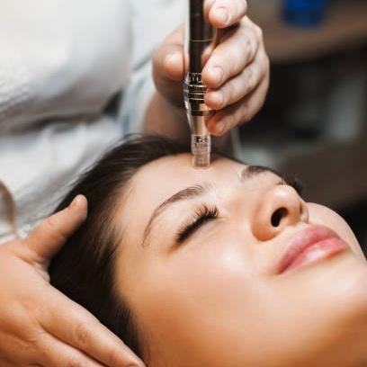 3 Series MicroChanneling