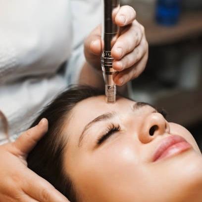 2 Series MicroChanneling